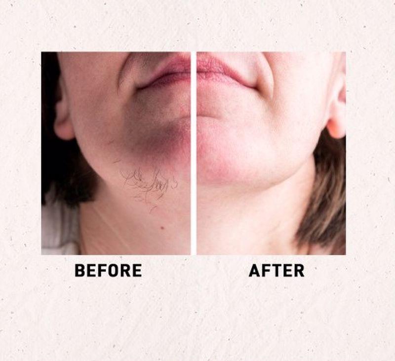 Chickpea & Kasturi Turmeric Facial Hair Depilatory Instant & Painless Facial Hair Removal Clay Powder (all Skin Types)